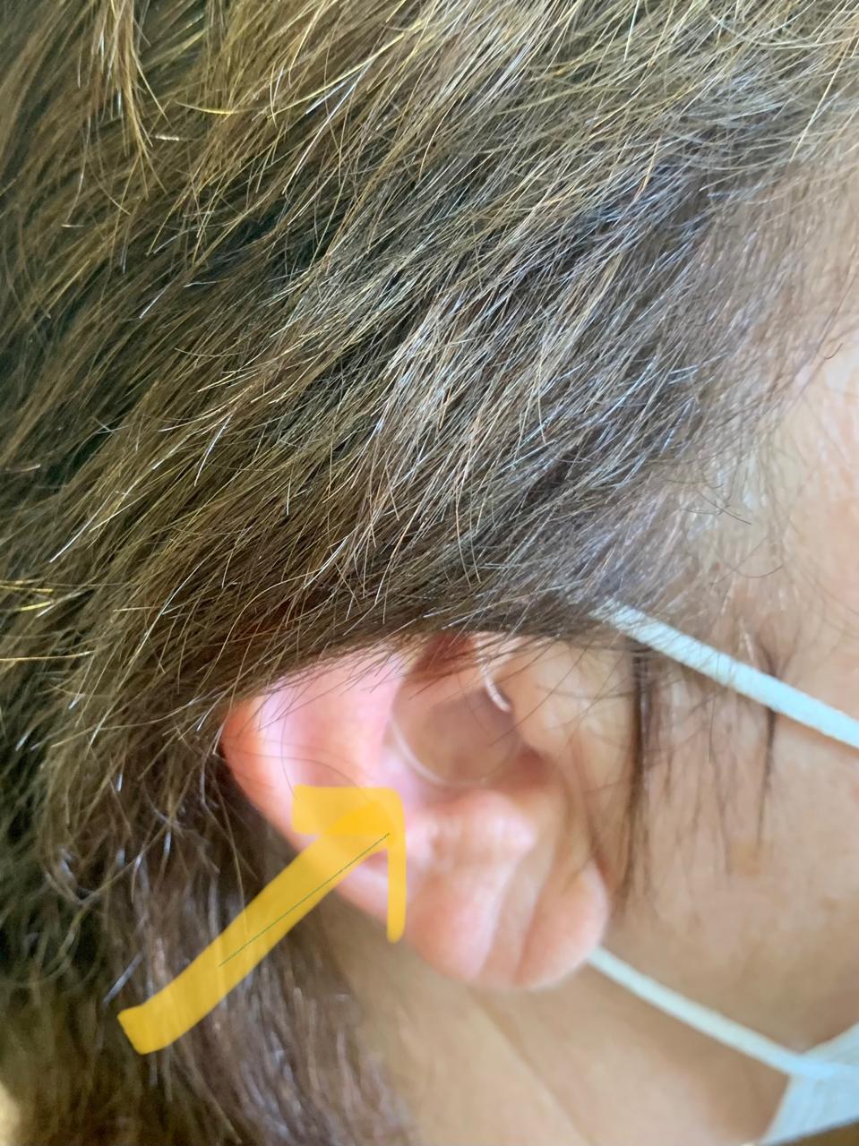 audiologia