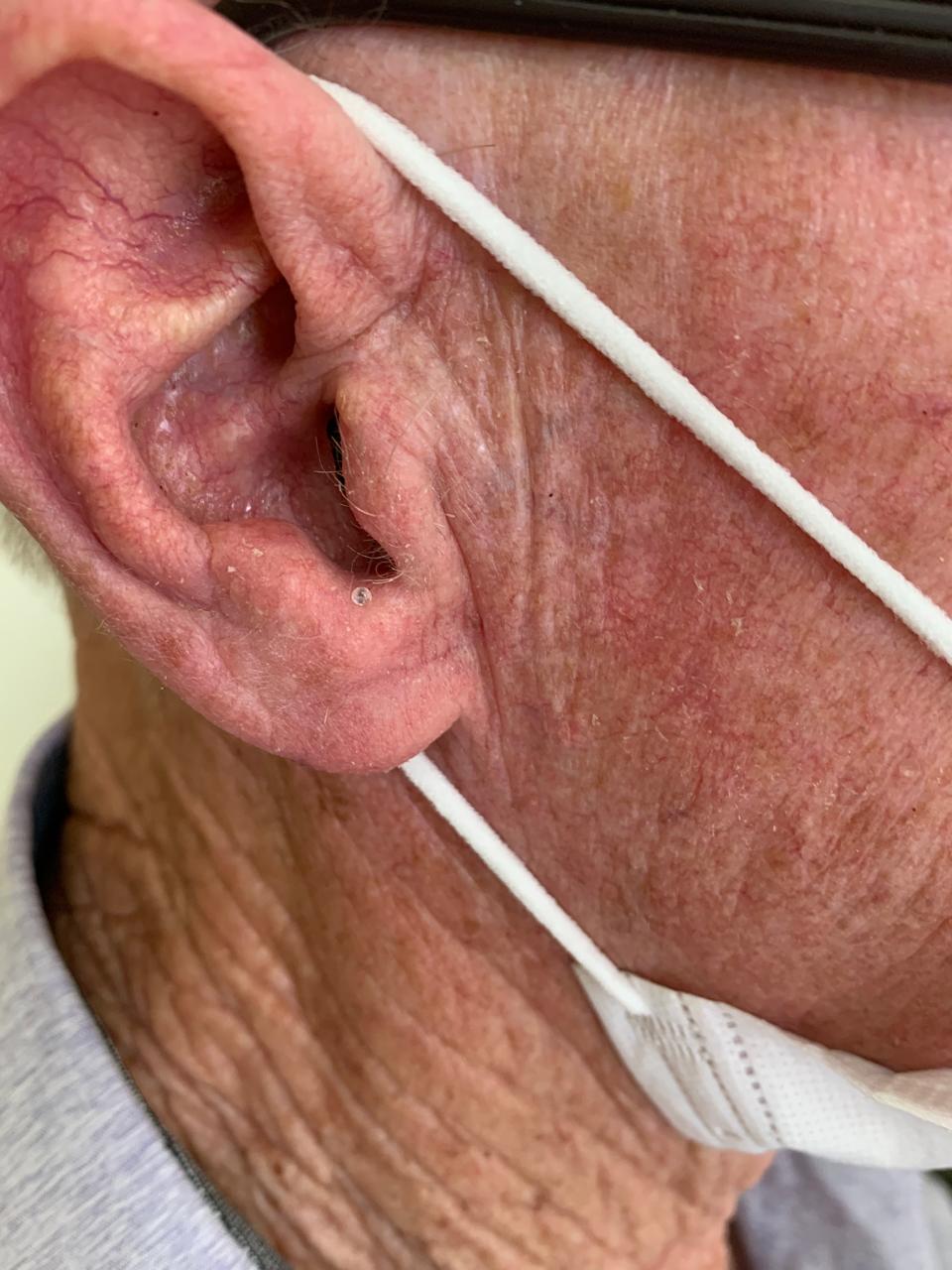 audiometria vocal